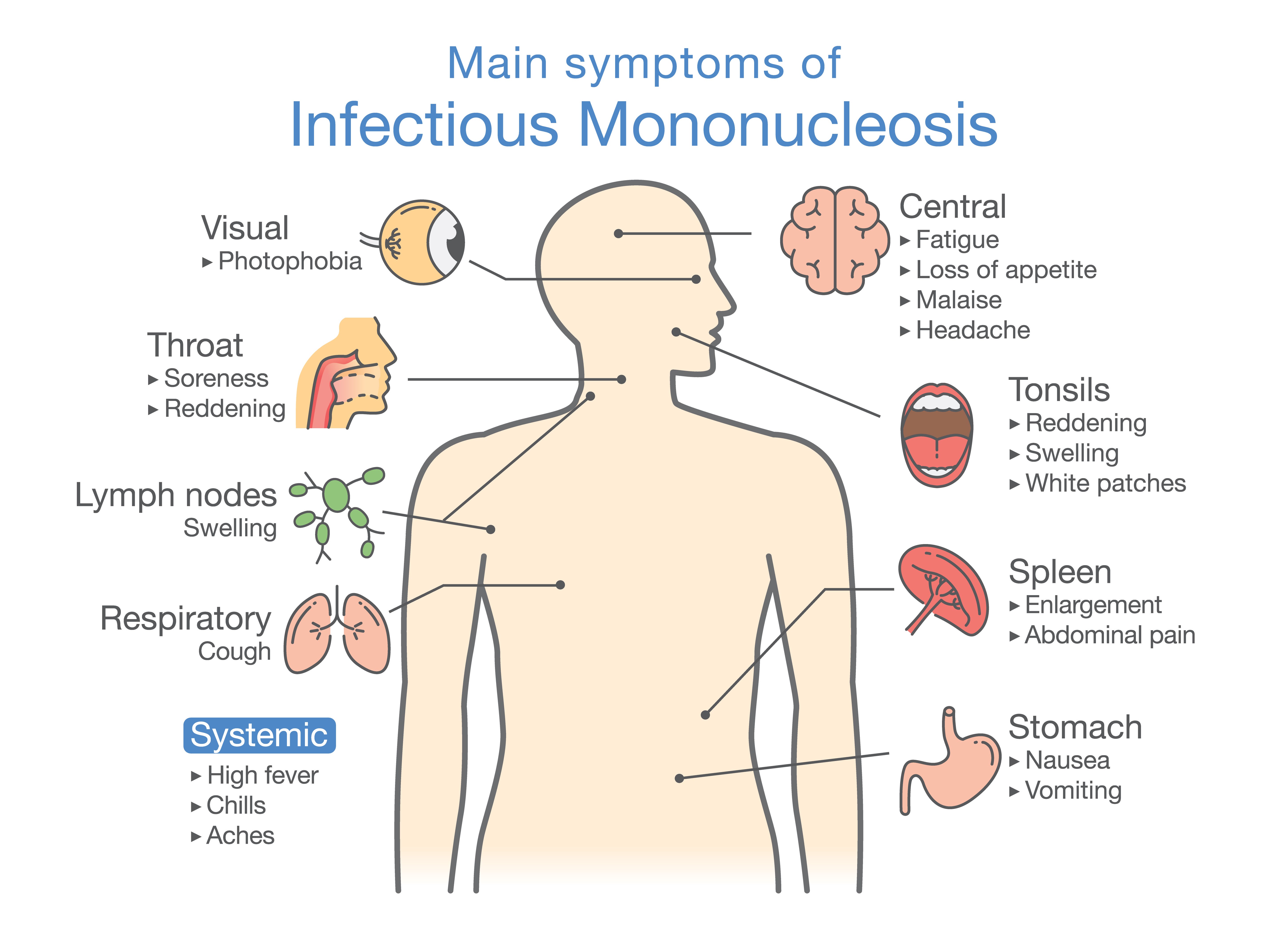 Mononucleosis Common Symptoms Care Excel Urgent Care